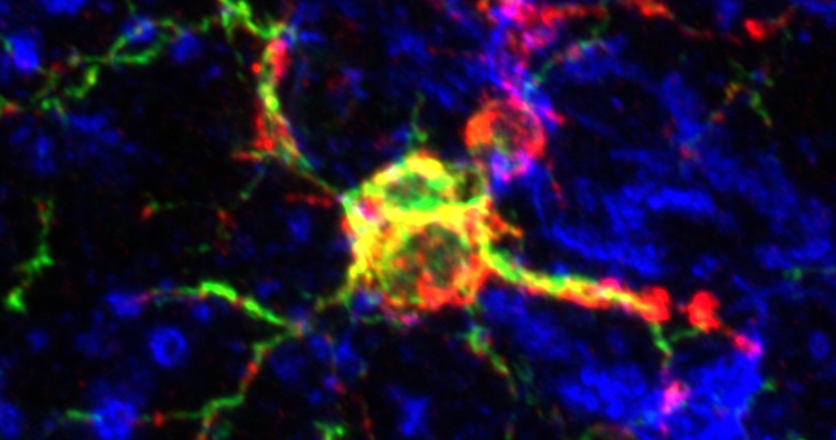 Simon R. Cherry Cherry Lab — Neuroimmunology & CTE Research | Boston University